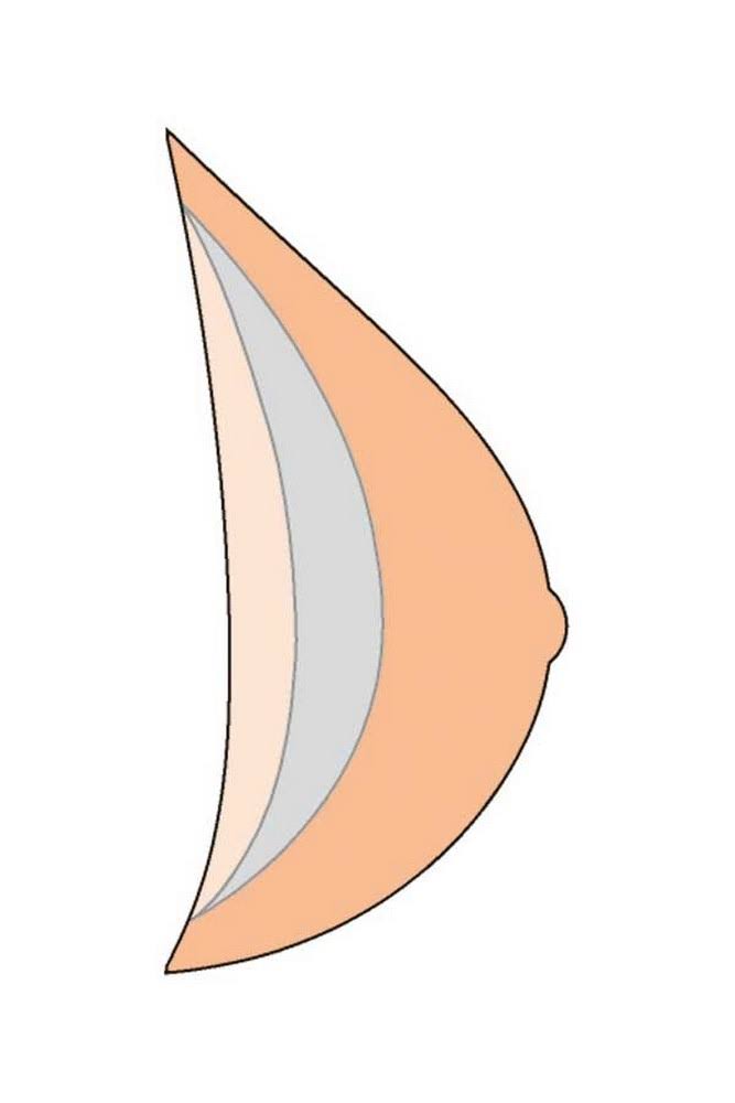Natura Xtra Light Breast Form Size 8 Q15004